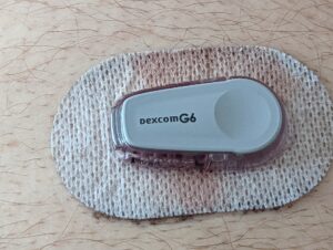 Hypos, Pumps and Prejudice: Diabetes Rights at Work, at School and Through Airport Security